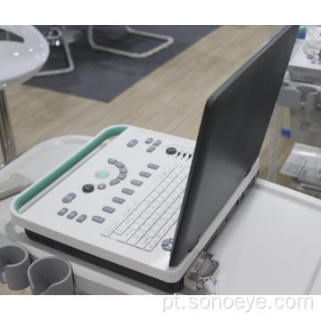 Scanner de ultra-som branco preto do laptop 2d